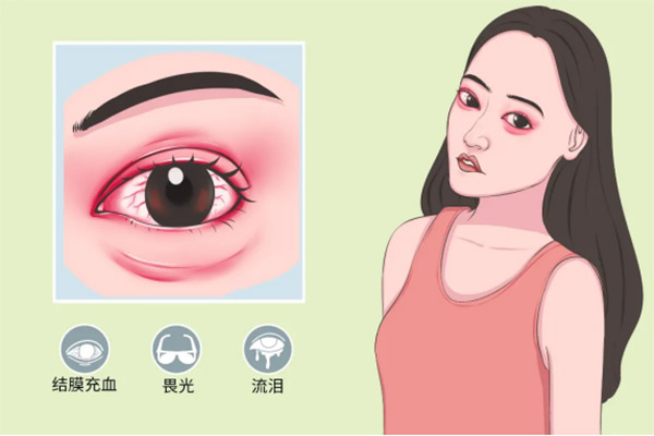 次氯酸治療細菌性和病毒性結膜炎 次氯酸治療細菌性和病毒性結膜炎