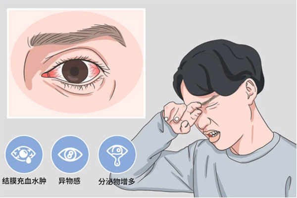 次氯酸治療細菌性和病毒性結膜炎 次氯酸治療細菌性和病毒性結膜炎