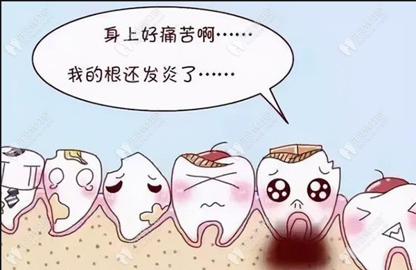 次氯酸消毒液對牙周炎的消毒 次氯酸消毒液對牙周炎的消毒