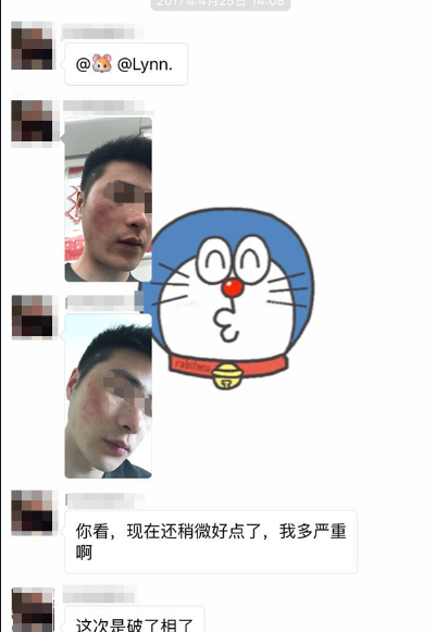 特應(yīng)性皮炎苦不堪言