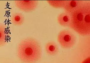支原體感染圖片